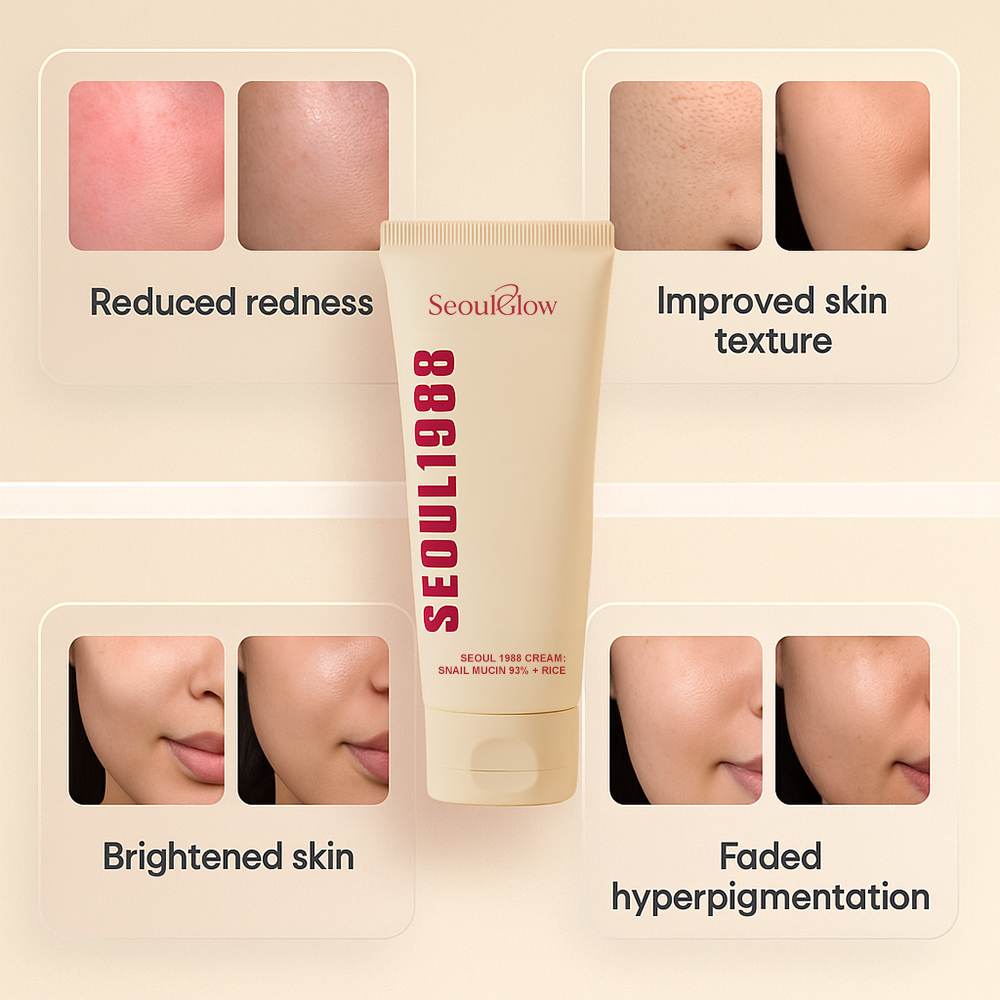 SeoulGlow™ - Cream : Snail Mucin 97% + Rice