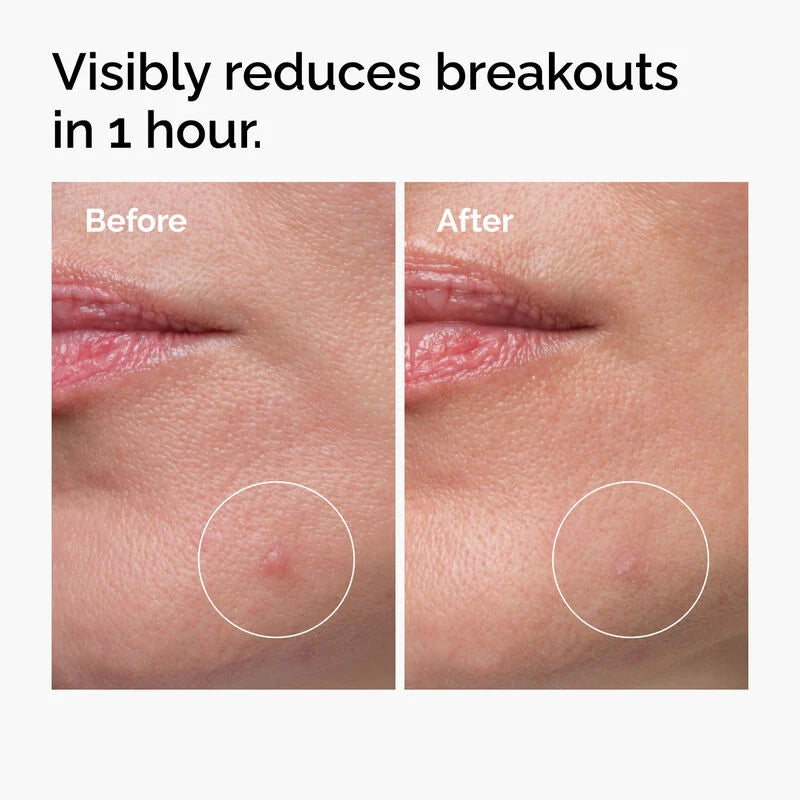The Ordinary - The Clear Face Solution