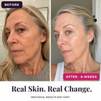 SeoulGlow - Retinol Wrinkle Care Set