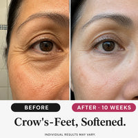 SeoulGlow - Retinol Wrinkle Care Set