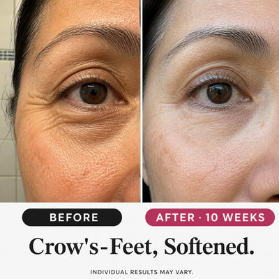SeoulGlow - Retinol Wrinkle Care Set