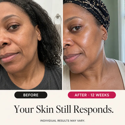 SeoulGlow - Retinol Wrinkle Care Set