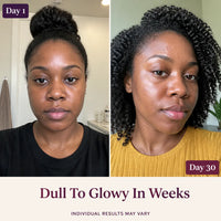 SeoulGlow - Korean Radiance Essence Duo
