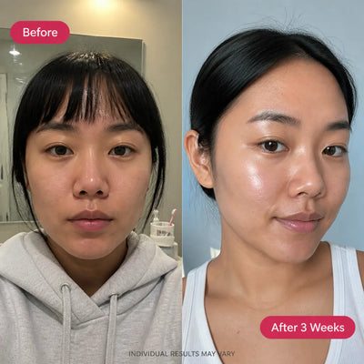 SeoulGlow - Pink Peptide 12 Serum 2