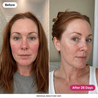 SeoulGlow - Hyaluronic Acid Capsule Serum