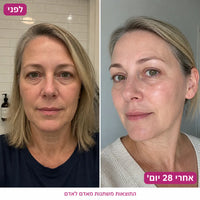 SeoulGlow - PDRN & NAD+ Lifting Serum Duo 2
