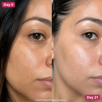SeoulGlow - PDRN & NAD+ Lifting Serum Duo 3