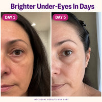 SeoulGlow - NAD+ Anti-Aging Eye Cream