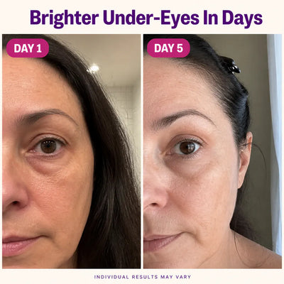 SeoulGlow - NAD+ Anti-Aging Eye Cream