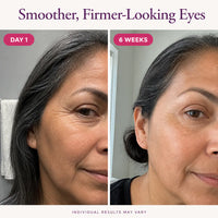 SeoulGlow - NAD+ Anti-Aging Eye Cream