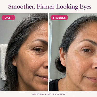 SeoulGlow - NAD+ Anti-Aging Eye Cream