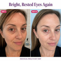 SeoulGlow - NAD+ Anti-Aging Eye Cream